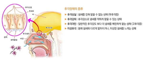 후각상실 원인, 염증성과 건조성을 구분해야