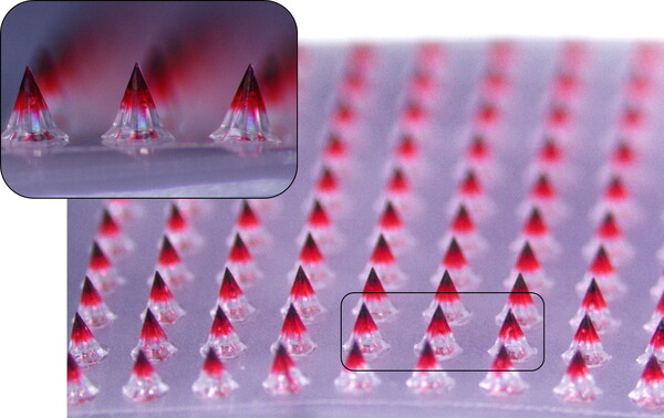 대웅테라퓨틱스가 개발한 마이크로니들 패치의 약물층을 시각적으로 표현하기 위해 색소를 첨가하고 6.7배 확대 촬영한 모습. 사진=대웅제약