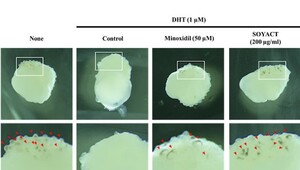 오가노이드사이언스·코스맥스, '남성형 탈모 재현 플랫폼' 공동 개발 - 뉴스 썸네일 이미지